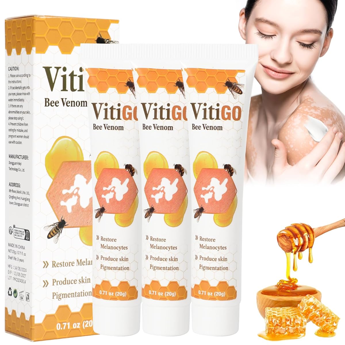 Vitigo Bee Venum
